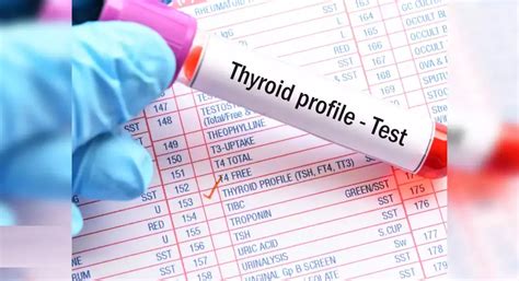 Thyroid Profile Test Preparation And Benefits