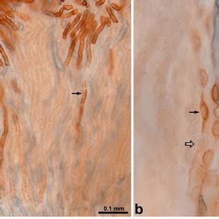 Light micrographs of 50 µm thick vibratome sections illustrating double