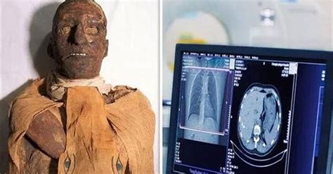 Scans of 3,000-year-old Egyptian pharaoh mummies, uncovering stunned secrets