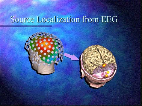 Source Localization From Eeg