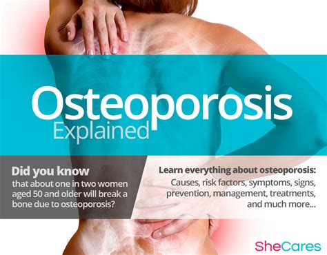 Osteoporosis Shecares