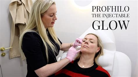 Profhilo The Injectable Glow Session 3 And Results YouTube