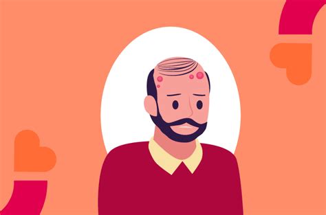 jerawat  kulit kepala   efektif mengatasinya