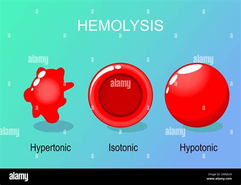 Hemolysis Of Red Blood Cells Hypertonic Hypotonic And Isotonic