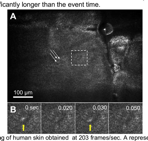 Figure 1 From High Speed Blood Flow Imaging With Scanless Confocal