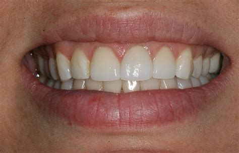 Why Healthy Gums Matter | Advanced Smile Care