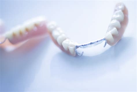 Do Partial Dentures Hurt | European Denture Center