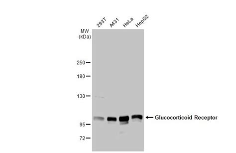 Glucocorticoid Receptor Nr C Monoclonal Antibody Hl