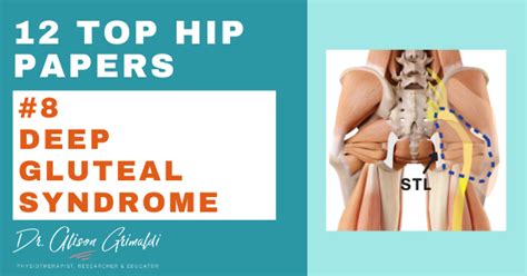 8 Of 12 Top Hip Papers Deep Gluteal Syndrome