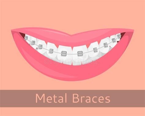 Cintas Dentais Bordos De Sorriso No Estilo Dos Desenhos Animados