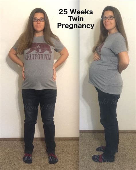 List 105 Pictures Pregnant With Triplets Week By Week Latest