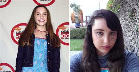 Amanda Bynes' Transformation: See Photos Of The Actress Before And After