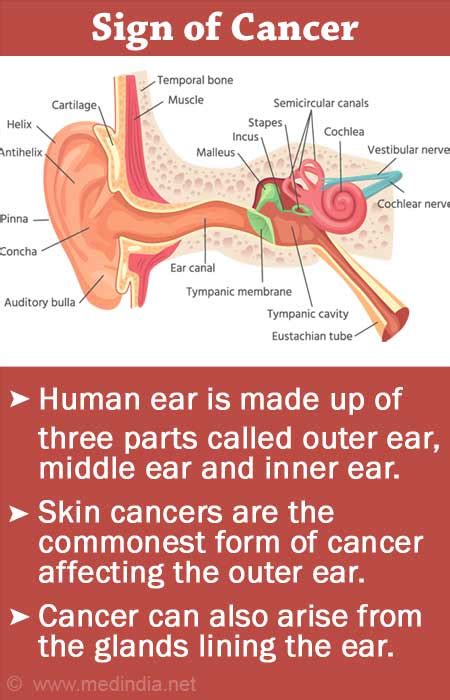 Cancerous Tumor Behind Ear