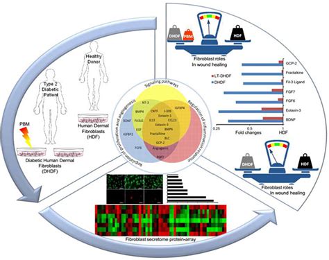 Why photobiomodulation therapy is helpful for diabetic wound healing ...