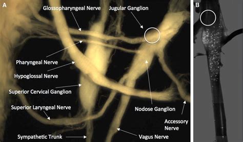 Distribution of neurons in the rat vagal afferent ganglia labeled by ...