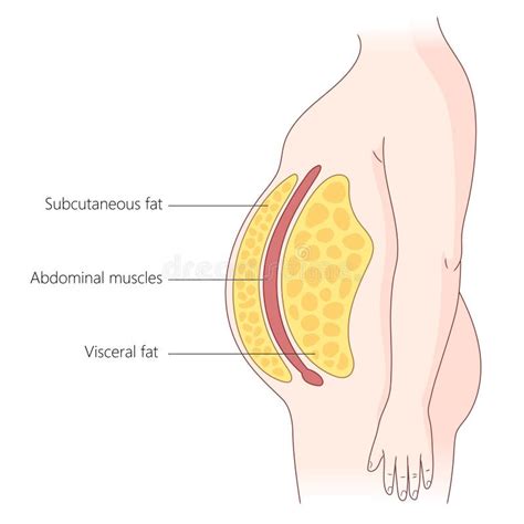 Subcutaneous And Visceral Fat Layers Medical Stock Illustration Illustration Of Drawing