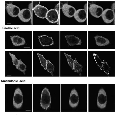 Translocation of γ PKCGFP induced by unsaturated fatty acids Top