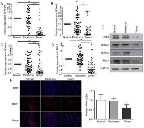 Effects Of MLL5 And HOXA Regulated By NRP1 On Radioresistance In A549