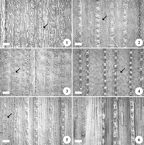 Figure 16 From Cuticle Micromorphology Of Leaves Of Pinus Pinaceae