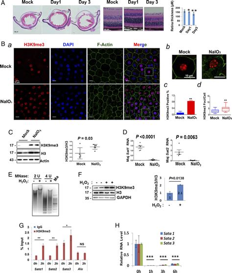 OS Induces Heterochromatin Formation A Histological Sections Of