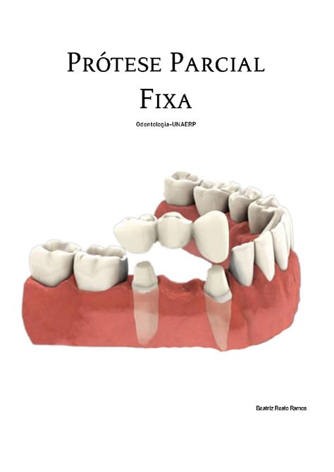 Pr Tese Parcial Fixa Odontologia Unaerp Beatriz Reato Ramos Pr Tese