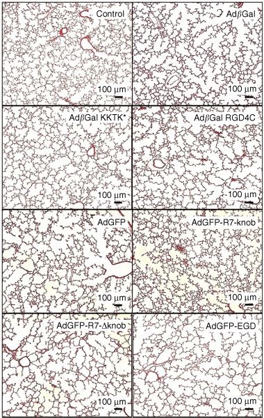 Histological analysis of bronchioalveolar parenchyma. Lungs were... | Download Scientific Diagram