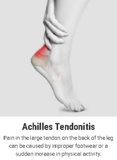 Achilles Tendonitis Pain Causes Treatment And Prevention Explained By Vancouver Orthotic