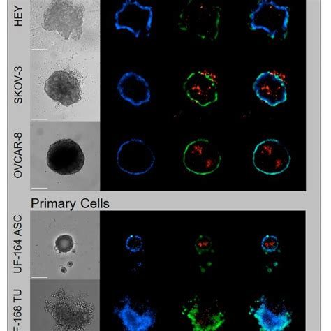 Generation And Classification Of Tumor Spheroids Using Ovca Cell Lines