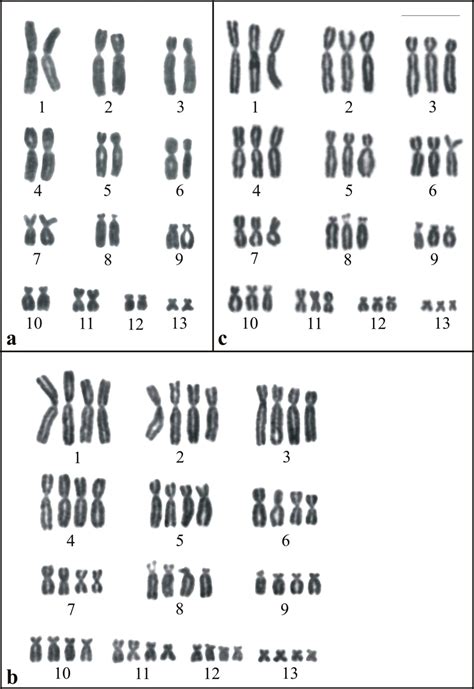 Solved Here Are Three Karyotypes From Three Different Chegg