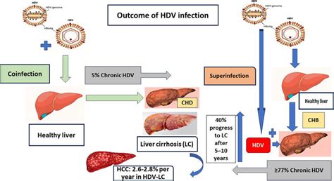 Prevalence And Impact Of HBV And HDV Infection Globally And In MENA