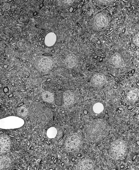 A Low Power Electron Micrograph Of A Thin Section Taken In The