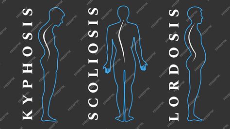 Premium Vector Diseases Of The Spine Scoliosis Lordosis Kyphosis