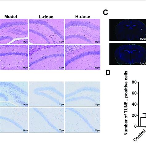 Blwe Reversed Neuron Pathological Damage And Neuronal Apoptosis In