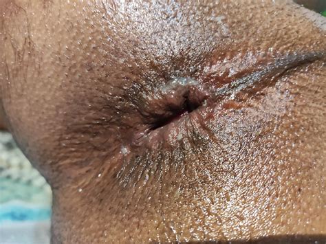 Anal Pleasure 3 Nude Pics XHamster