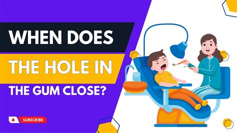 Wisdom Tooth Hole Never Close Here Is What You Can Do YouTube