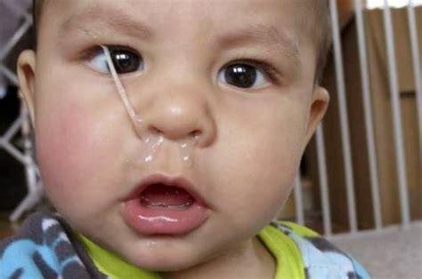 Warna Hingus Yang Keluar Dari Hidung Jadi Petanda Kesihatan Anak