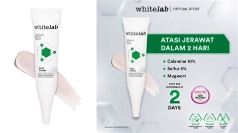 Review Whitelab Acne Cream Obat Totol Atasi Jerawat Dalam 2 Hari