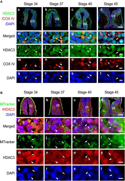 Frontiers Subcellular Localization Of Class I Histone Deacetylases In