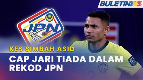 Kes Simbah Asid Hasil Semakan Tiga Kesan Cap Jari Tiada Dalam Rekod