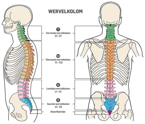 Wat Is Een Hernia Of Discushernia Dorsoo