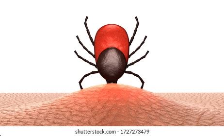 female tick embedded human skin drendering stock illustration