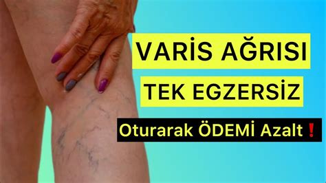 ÖDEMİ OTURARAK AZALT VARİS AĞRISI İÇİN TEK EGZERSİZ