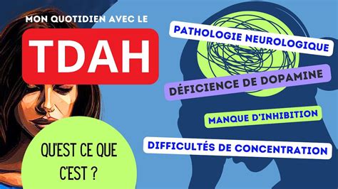 Tdah Pathologie Neurologique Youtube