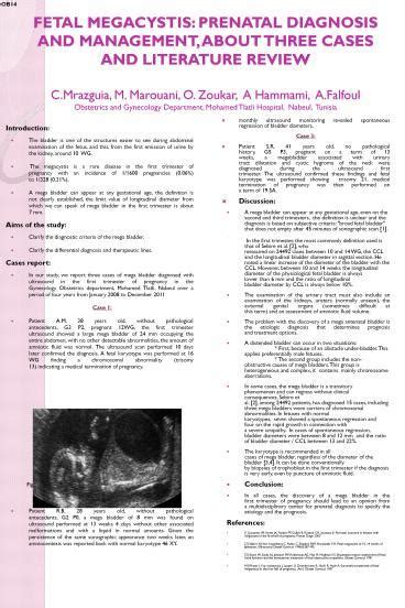 Ppt Fetal Megacystis Prenatal Diagnosis And Management About Three