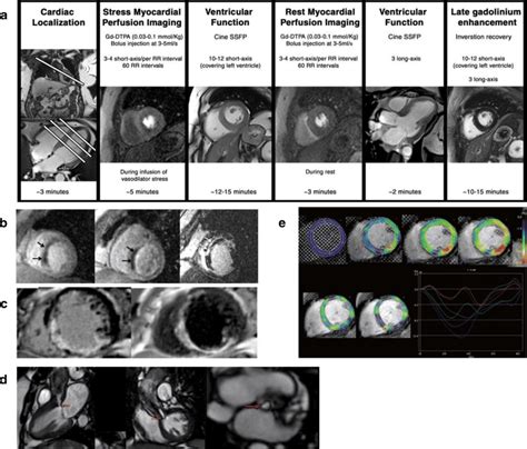 Cardiac Mri A Acquisition Protocol Includes Assessment At Rest And