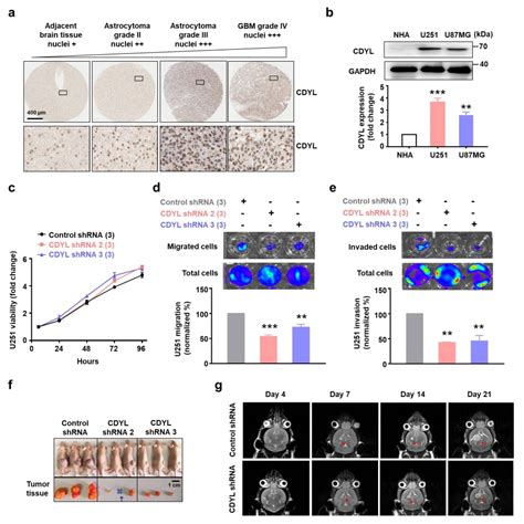 王韵课题组在《cancer Letters》发表题为“cdyl Knockdown Reduces Glioma Development