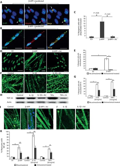 Targeting Protein Homeostasis In Sporadic Inclusion Body Myositis