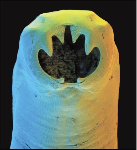 Ancylostoma Duodenale Scheda Parassitologica Ed Approfondimenti