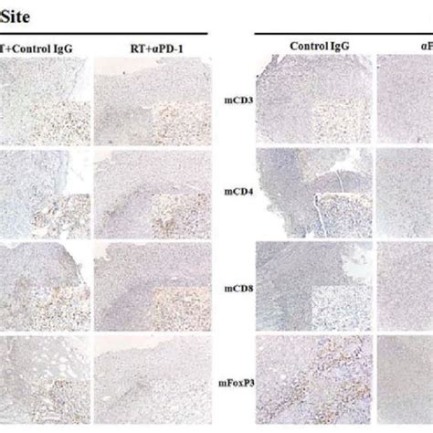 Ihc Staining Of Tumor Tissues With Cd Cd Cd And Foxp Tumors