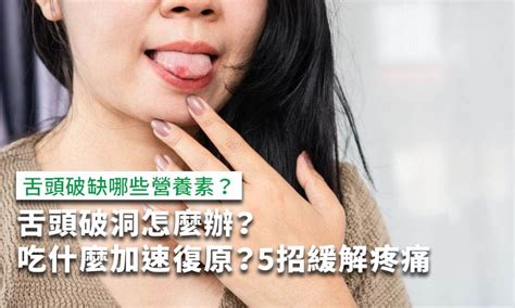 舌頭破洞怎麼辦？舌頭破吃什麼加速復原？5招緩解疼痛 康健雜誌